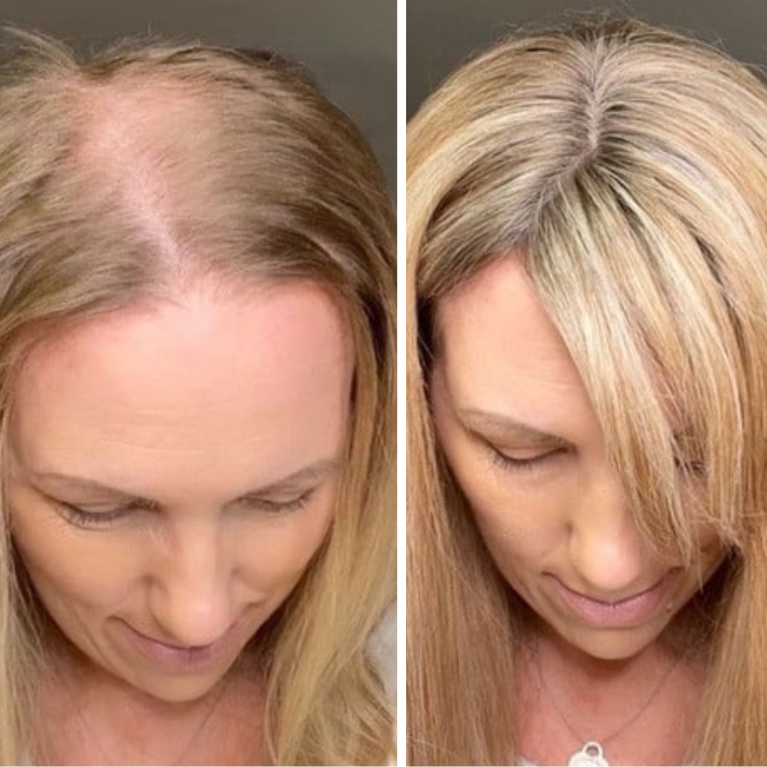 V1 Hair Growth Blend